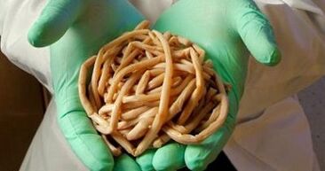 Aus dem menschlichen Körper extrahierte Parasiten