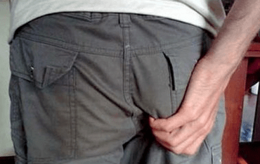 Juckreiz im Anus als Symptom für das Vorhandensein von Parasiten