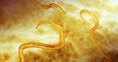 Madenwurmparasiten im menschlichen Körper