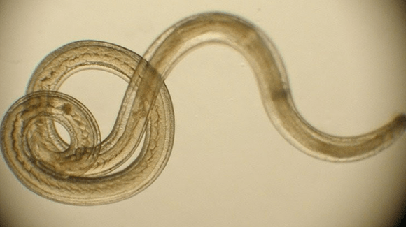 parasitärer Wurm aus dem menschlichen Körper