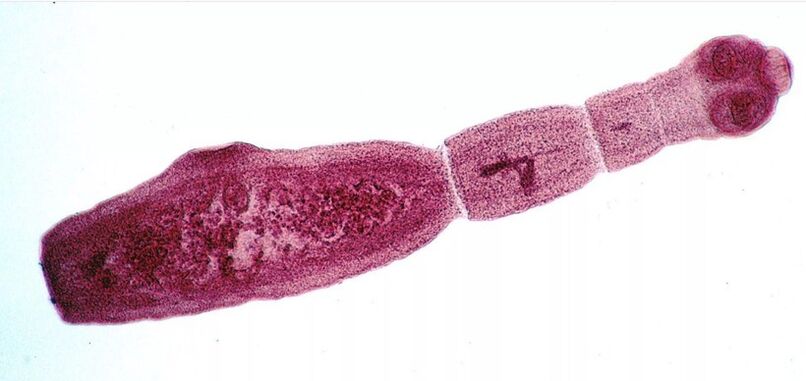 Echinococcus ist einer der gefährlichsten Parasiten für den Menschen