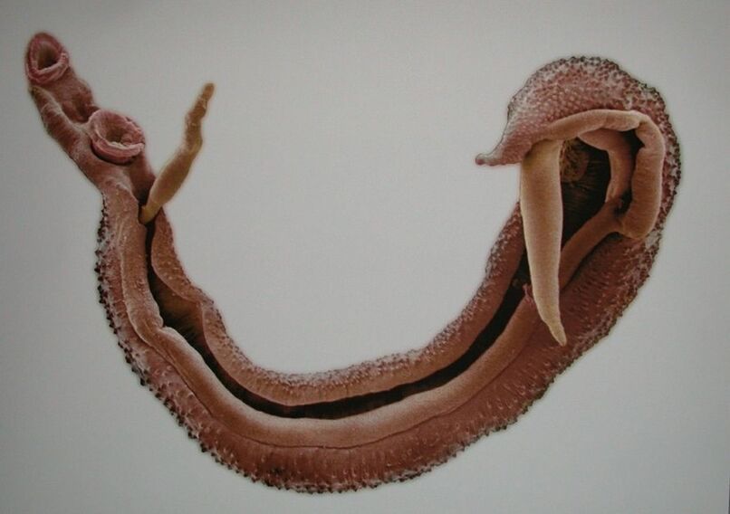 Schistosomen sind ein gefährlicher Parasit im menschlichen Blut