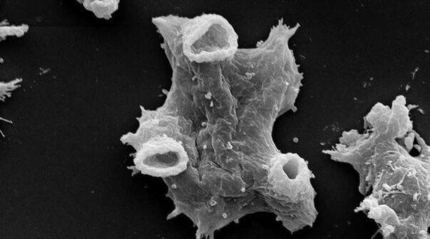 Negleria fowlera ist ein parasitäres Protozoon, das für das menschliche Leben gefährlich ist. 